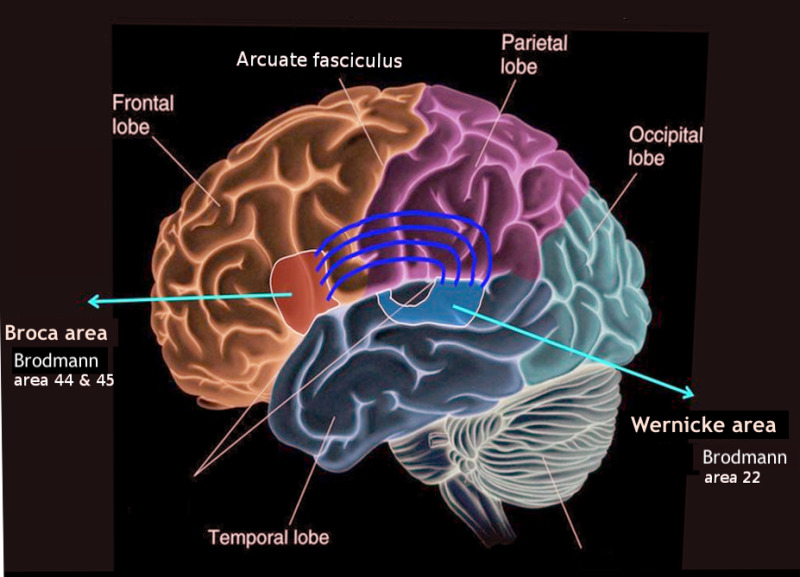 Lateral brain diagram highlighting Broca's area in the frontal lobe and Wernicke's area in the temporal lobe.